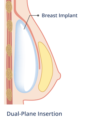 What does a breast look like on the inside?