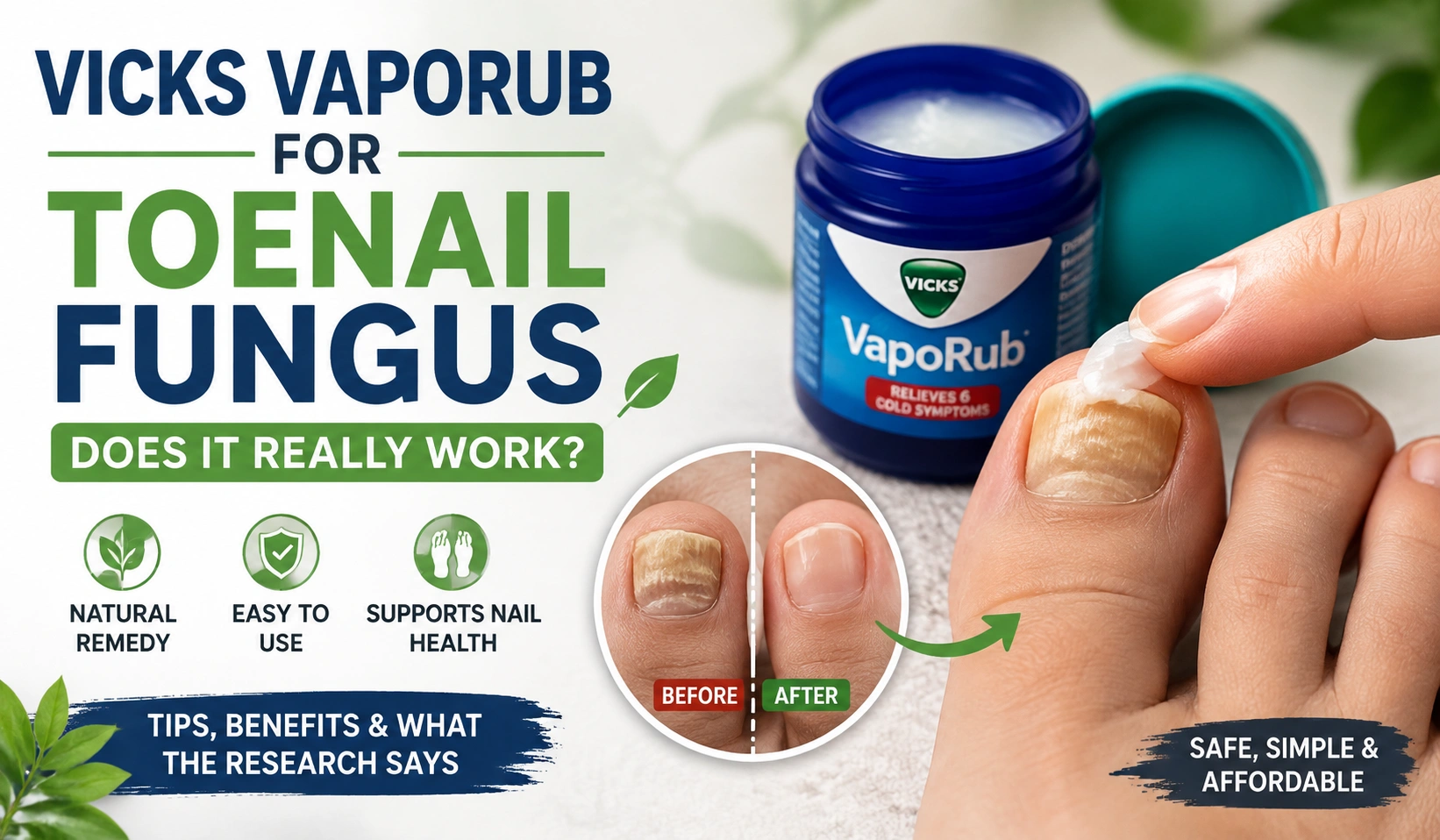 Vicks VapoRub for Toenail Fungus